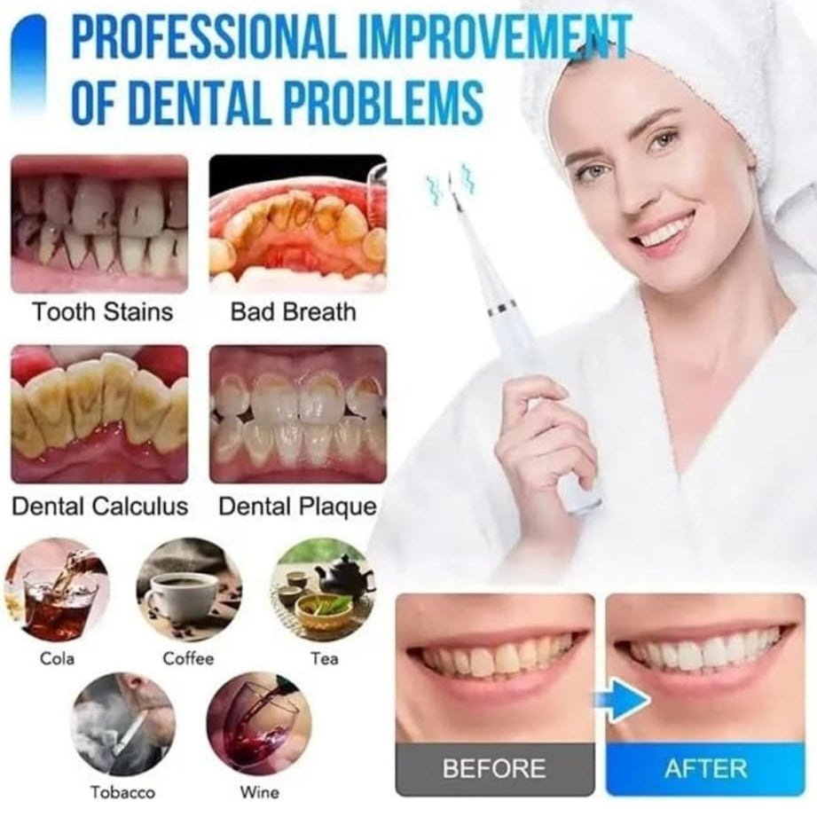 ELECTRIC TOOTHBRUSH TEETH CLEANER SET---- 2 HEADS /SCALLER /MIRROR